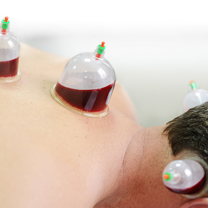 About Hijama