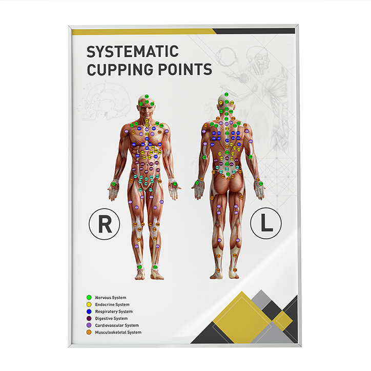A3 Poster Systematic Cupping Points
